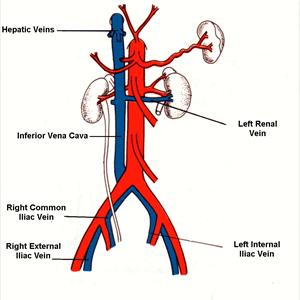 Vein Treatment Houston - Natural Care For Varicose Veins